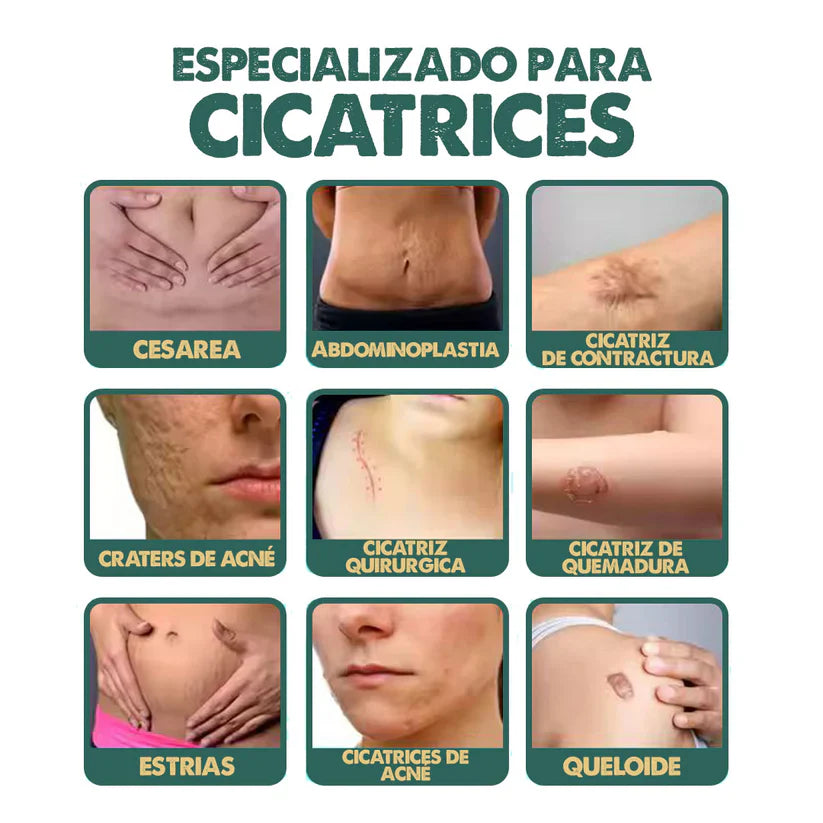 South Moon Spray para cicatrices