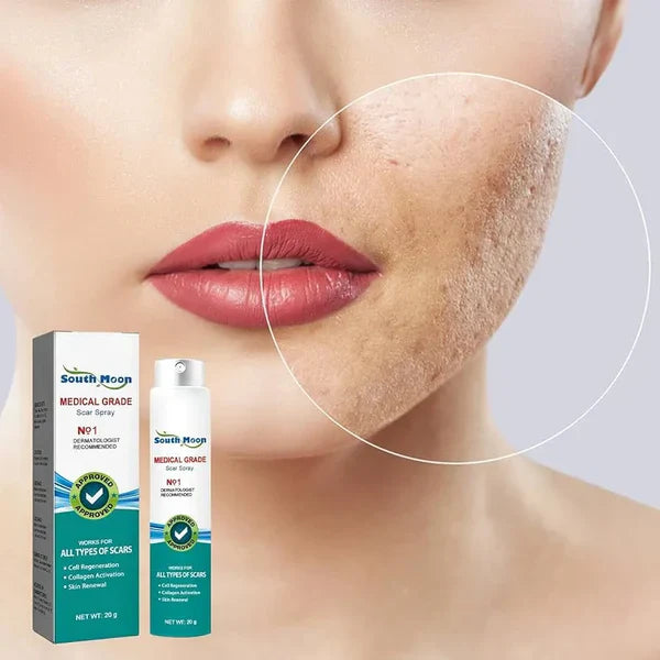 South Moon Spray para cicatrices