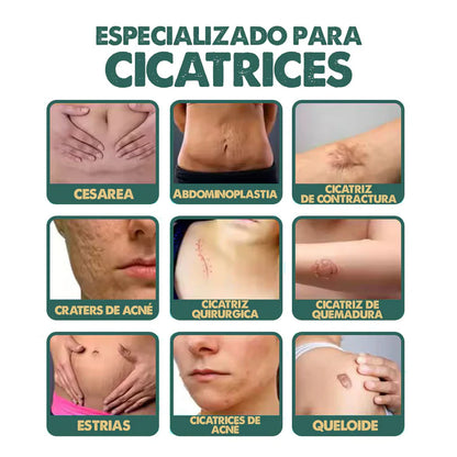 South Moon Spray para cicatrices